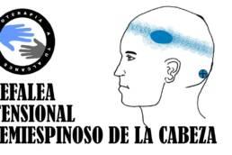 Dolor de cabeza,  masaje del musculo semiespinoso de la cabeza para la cefalea tensional