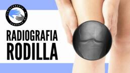 Dolor de rodilla, ¿cuando es necesaria una radiografia?