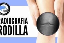 Dolor de rodilla, ¿cuando es necesaria una radiografia?