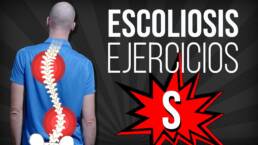 ESCOLIOSIS en S EJERCICIOS correctivos