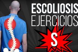 ESCOLIOSIS en S EJERCICIOS correctivos