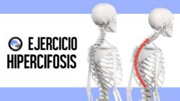Ejercicio para la hipercifosis dorsal, joroba o chepa