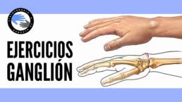 Ejercicios para el  ganglion de muñeca o quiste sinovial