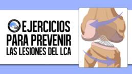 Ejercicios para prevenir la rotura del ligamento cruzado anterior