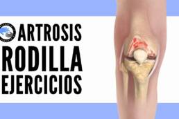 Ejercicios para tratar y evitarla artrosis de rodilla