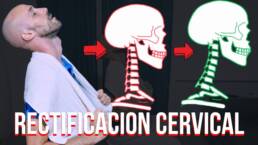 El MEJOR ejercicio para la RECTIFICACION CERVICAL