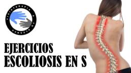 Escoliosis en S, ejercicios para aliviar el dolor, como mejorar tu postura