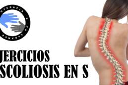 Escoliosis en S, ejercicios para aliviar el dolor, como mejorar tu postura