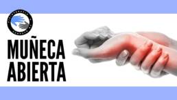 Esguince de muñeca o muñeca abierta, que es, causas, síntomas y tratamiento en fisioterapia