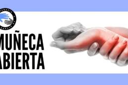 Esguince de muñeca o muñeca abierta, que es, causas, síntomas y tratamiento en fisioterapia