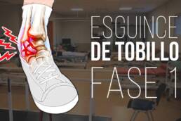 Esguince de tobillo ejercicios y recomendaciones para los primeros dias FASE 1