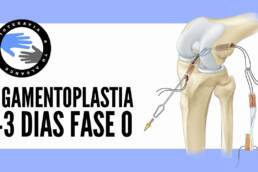 FASE 0: Ligamentoplastia rehabilitacion para la operacion del ligamento cruzado anterior