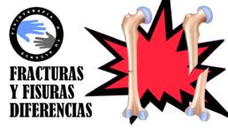 Fractura y fisura, diferencias, definicion y fases de consolidacion