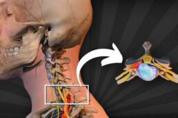 HERNIA CERVICAL: 7 EJERCICIOS para  que CAMBIARÁN tu cuello para SIEMPRE