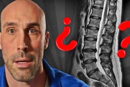 HERNIA DISCAL: lo que NADIE te explica de tu RESONANCIA