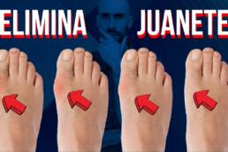 Hallux valgus o juanete, 1 ejercicio y 3 técnicas de masaje para aliviar el dolor
