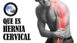 Hernia de disco cervical o hernia discal cervical, que es y porque se produce