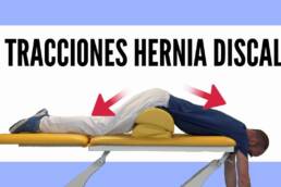 Hernia discal, 2 tracciones para descomprimir la columna lumbar