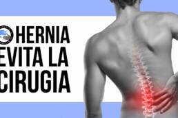 Hernia discal, 3 ejercicios para evitar la cirugia