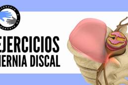 Hernia discal lumbar, programa de ejercicios para la fase intermedia