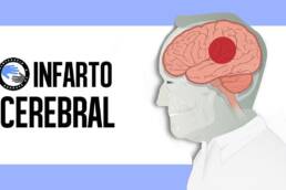 Ictus, acv o infarto cerebral ¿que es? identificacion y prevencion