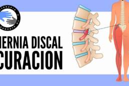 Las hernias de disco se curan con el tiempo