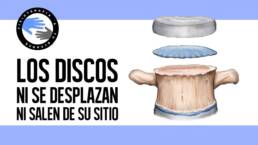 Los discos intervertebrales no se desplazan ni se salen de su sitio