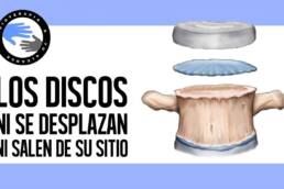 Los discos intervertebrales no se desplazan ni se salen de su sitio