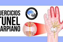 Los mejores ejercicios para el sindrome del tunel carpiano