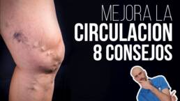 Mala circulación y varices  8 consejos para su prevención y tratamiento