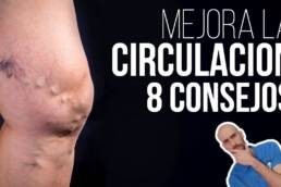 Mala circulación y varices  8 consejos para su prevención y tratamiento