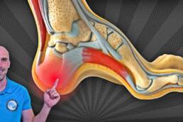 PIE CAVO Y DOLOR DE TALÓN – 3 EJERCICIOS para ALIVIAR la Fascitis Plantar