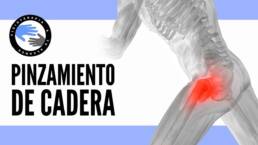 Pinzamiento de cadera, ejercicios para aliviar el dolor