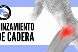 Pinzamiento de cadera, ejercicios para aliviar el dolor