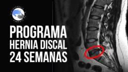 Programa de ejercicios para hernia discal de 24 semanas de duracion