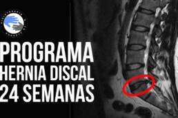 Programa de ejercicios para hernia discal de 24 semanas de duracion