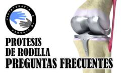 Protesis de rodilla , preguntas frecuentes