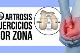 Que ejercicios hacer segun la artrosis de rodilla que tengas