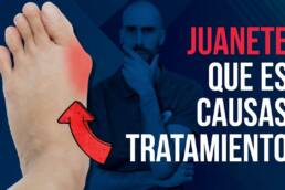 Que es el juanete o hallux valgus, causas y tratamiento