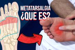 Que es la METATARSALGIA, causas, sintomas y tratamiento