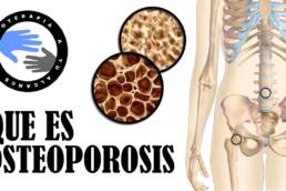 Que es la osteoporosis y porque se produce