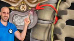 RUTINA de EJERCICIOS para la HERNIA DISCAL – 30 MINUTOS