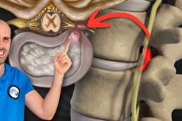 RUTINA de EJERCICIOS para la HERNIA DISCAL – 30 MINUTOS