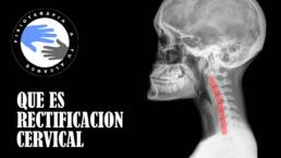 Rectificacion cervical, que es y como se produce