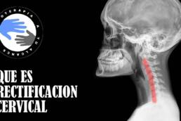 Rectificacion cervical, que es y como se produce
