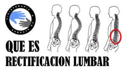 Rectificacion lumbar, que es y porque se produce
