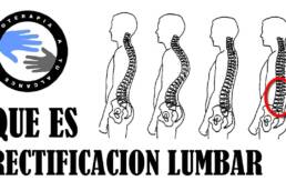 Rectificacion lumbar, que es y porque se produce