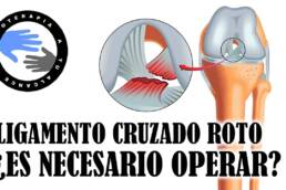 Rotura de ligamentos cruzados, ¿es necesaria la operacion?