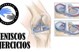 Rotura de menisco y operacion de meniscos, rehabilitacion y ejercicios