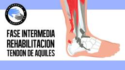 Rotura del tendon de aquiles, ejercicios y rehabilitacion postcirugia en la fase intermedia